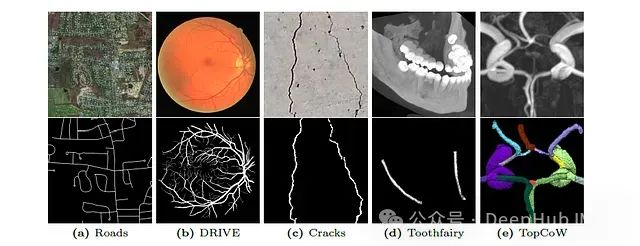 Skeleton Recall Loss 分割领域的新突破：极大的减少了资源消耗，还能提高性能